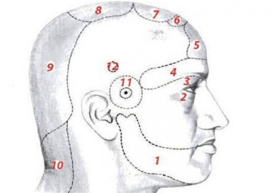 FEJFÁJÁS: fontos, hogy a fej melyik részén jelentkezik a fájdalom